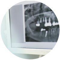 Röntgenaufnahme von Zähnen